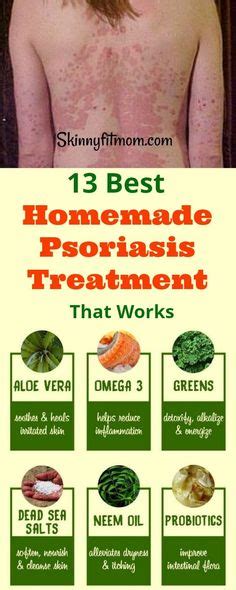 Psoriasis