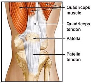 Patellar Dislocations: Signs, Symptoms and Treatments - High Mountain Orthopedics