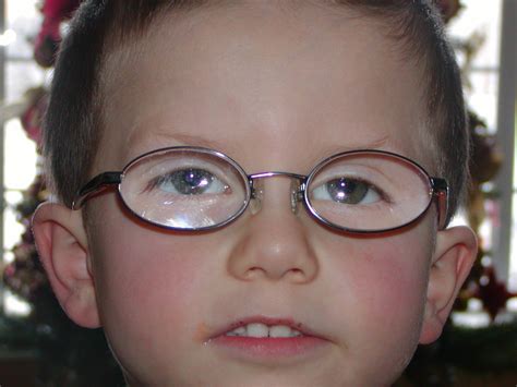 pictures of kids in glasses with a strong prescription | For Little Eyes