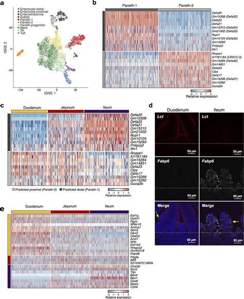 Regional variation in Paneth cell subtypes and stem cell markers a ...