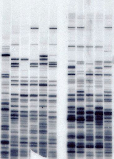 What is DNA Fingerprinting - What can be discovered in your code?