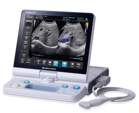 Premium portable ultrasound – International Hospital