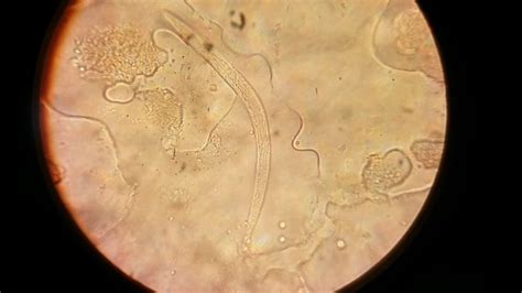 Strongyloides stercoralis rhabditiform larvae - YouTube