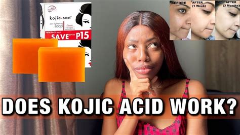 Watch this before you use KOJIC ACID | Kojie San soap for hyperpigmentation and dark spots ...