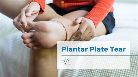 Plantar Plate Tear Injury Treatment - Moore Foot and Ankle Specialists