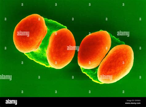 Pollen microscope tree hi-res stock photography and images - Alamy