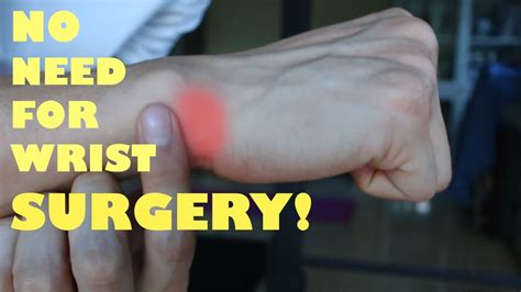 WRIST PAIN FIXED in 6 minutes | BABY FINGER SIDE OF THE WRIST | Physiotherapy | Physio ...