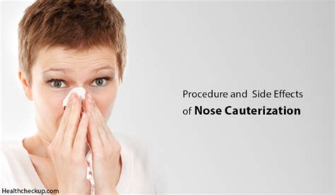 Precautions, Procedure and Side Effects of Nose Cauterization