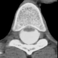 Neuroradiology Reading Room: Case s31