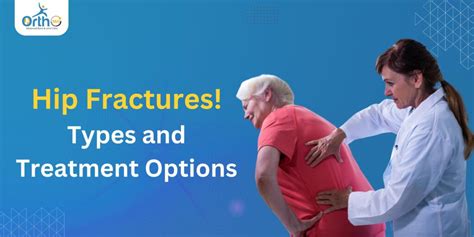 Types of hip fractures and Treatment - Ortho 360