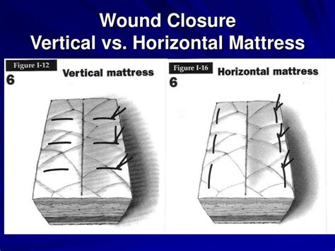 PPT - Suture Workshop Intermediate Skills PowerPoint Presentation - ID:64374