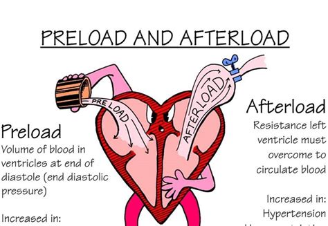 Nursing Mnemonics: Preload vs Afterload - StudyPK