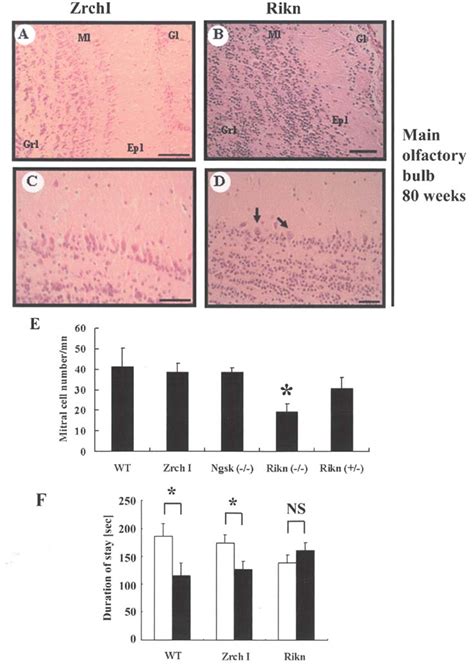 Olfactory functions and histopathological findings of the olfactory ...