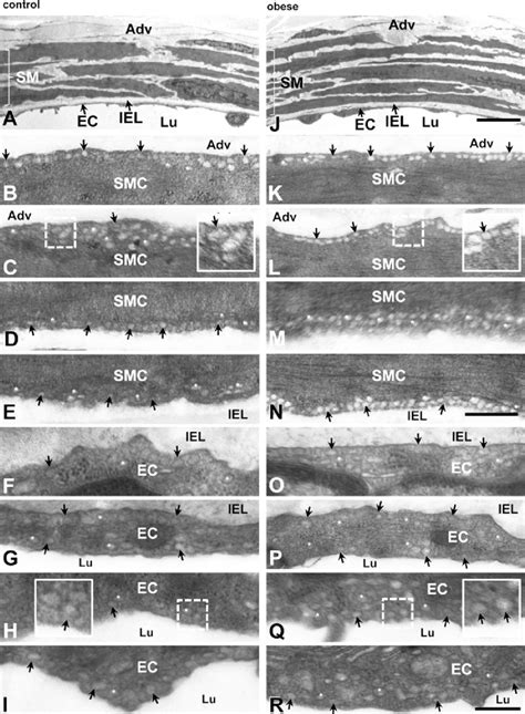 Caveolae morphology and distribution. Caveolae are nonuniformly ...