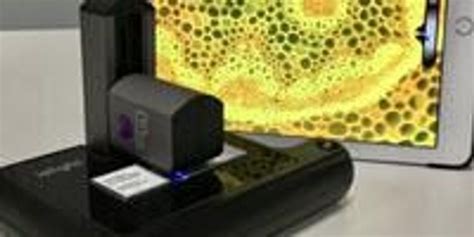 ioLight Launches Its Compact and Portable Fluorescence Microscope | Lab Manager