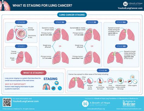 What is Staging for Lung Cancer?