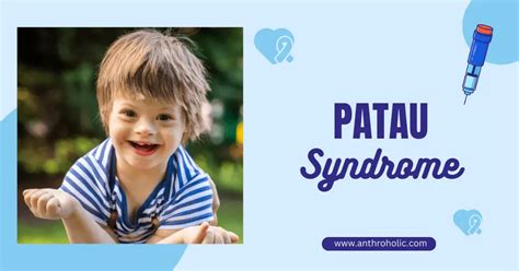 Patau Syndrome (Trisomy 13) | Anthroholic