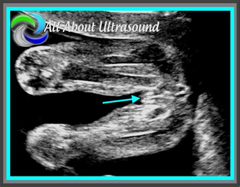 5 Best Practice Tips to OB GYN Ultrasound