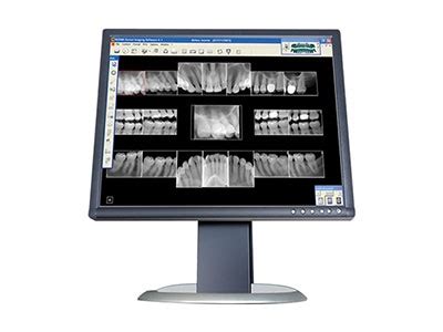 SIDEXIS 4 from Dentsply Sirona Imaging | Dentalcompare: Top Products. Best Practices.