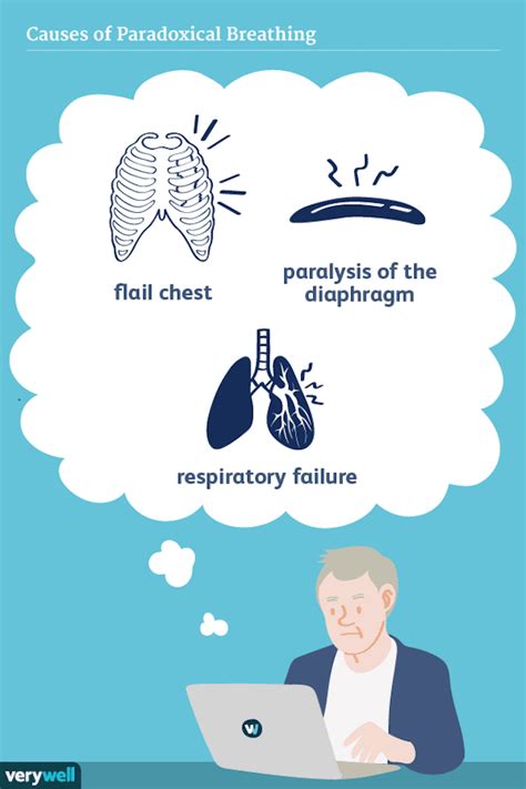 Paradoxical Breathing: Symptoms, Causes, and Treatment