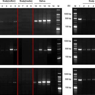 Gel electrophoresis of PCR products. M, 25/100 bp mixed DNA Ladder ...