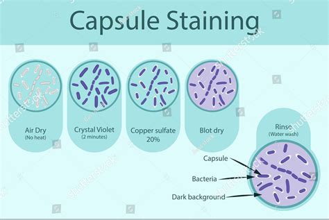 Capsule Staining: Principle, Methods, Procedure and Examples | Biology Ease