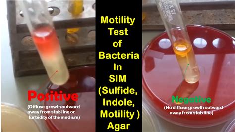 Bacterial Motility Test: Principle, Test Requirements, Procedure, Result