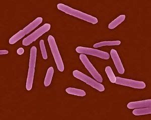 Clostridium tetani - microbewiki