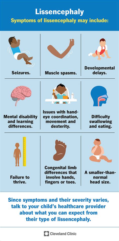 Lissencephaly (Smooth Brain): What It Is, Causes & Symptoms