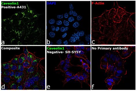 Caveolin 1 Antibody (MA5-16329)