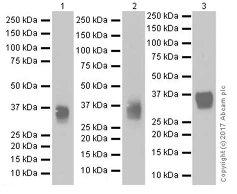 Recombinant Anti-CD8 alpha antibody [EPR20305] (ab209775) | Abcam