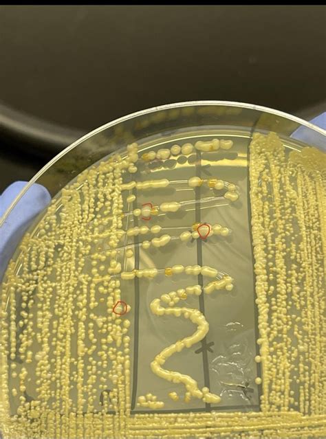 Identifying an unknown gram-positive endospore forming bacteria : r ...