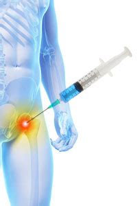 Pain Clinic NYC | Sacroiliac Joint Injections