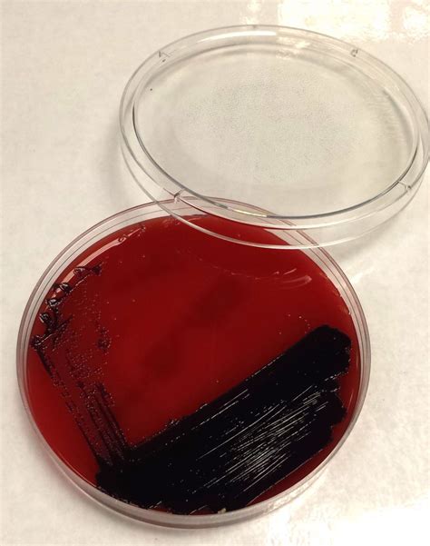 Pathology Questions