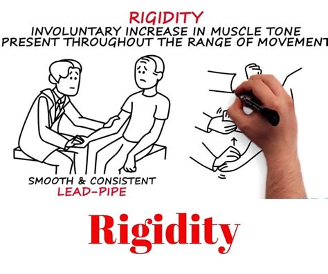 What are Spasticity and Rigidity? Spasticity - Rigidity Comparison-Treatment