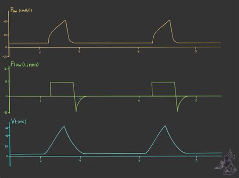 Riding the Waves: Ventilator Waveform Interpretation – CriticalCareNow