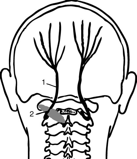 Sonographic visualization and ultrasound-guided blockade of the greater occipital nerve: a ...