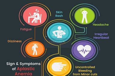 Aplastic Anemia Signs And Symptoms