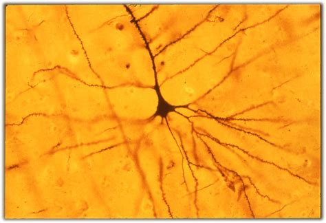 The Cellular Scale: Seeing Cells: Nissl and Golgi together at last