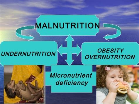 EMANTHI-NEWSBLOG: Malnutrition Among Local Children Under 5 Years Is On The Decrease-Over ...