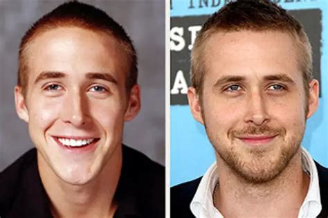 Ryan Gosling Plastic Surgery Before and After | Celebie