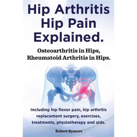 Hip Arthritis, Hip Pain Explained. Osteoarthritis in Hips, Rheumatoid ...