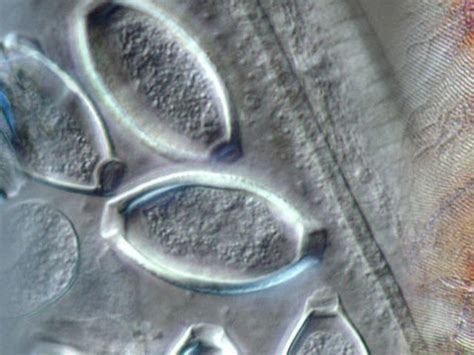 Differential Interference Contrast (DIC) | MicroscopyU