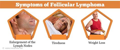 Follicular Lymphoma Symptoms