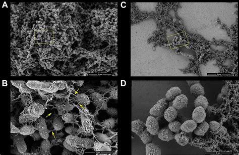 Frontiers | Theaflavin-3,3′-Digallate Suppresses Biofilm Formation ...