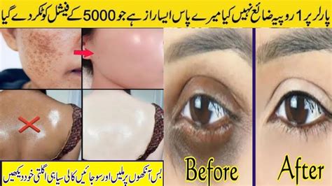 Best Skin Whitening Cream Homemade | Homeremedies for dark circles | Natural remedies - YouTube