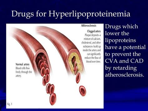 PPT - Hyperlipoproteinemia PowerPoint Presentation - ID:628585