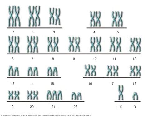 The genetic basis of Down syndrome - Mayo Clinic