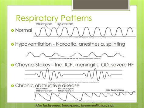 PPT - Respiratory Assessment NURS 113 PowerPoint Presentation - ID:2159691