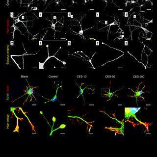 Effect of CES on growth cone F-actin dynamics and morphology in... | Download Scientific Diagram